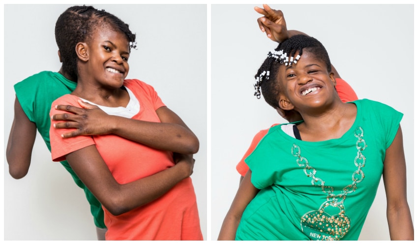 Siamese Tweeling Chenelva En Sheneeva