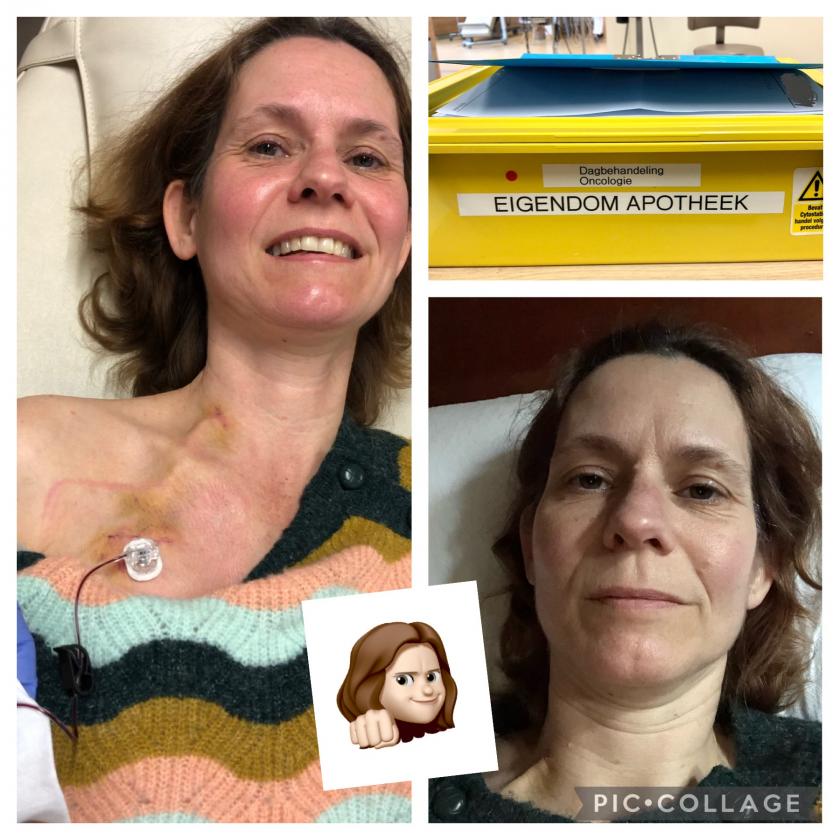 Welke Chemo Is Het Zwaarst