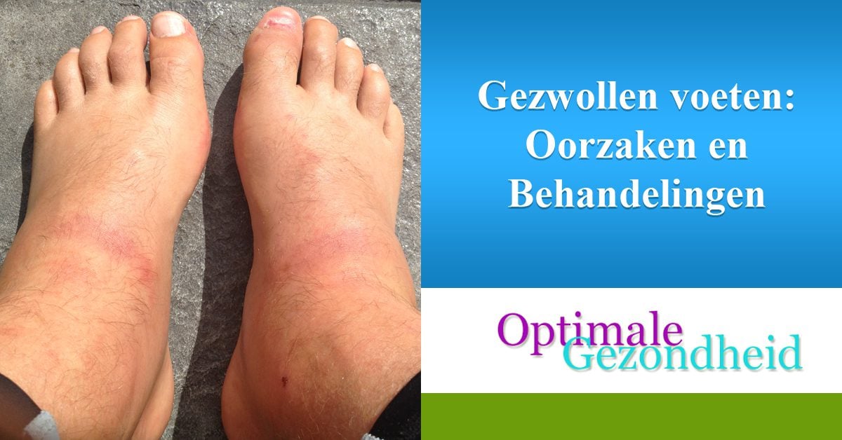 Gezwollen Voeten Oorzaak