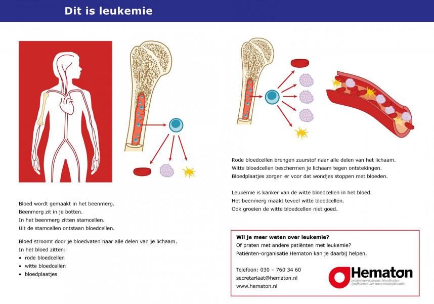 Acute Leukemie Snel Overlijden