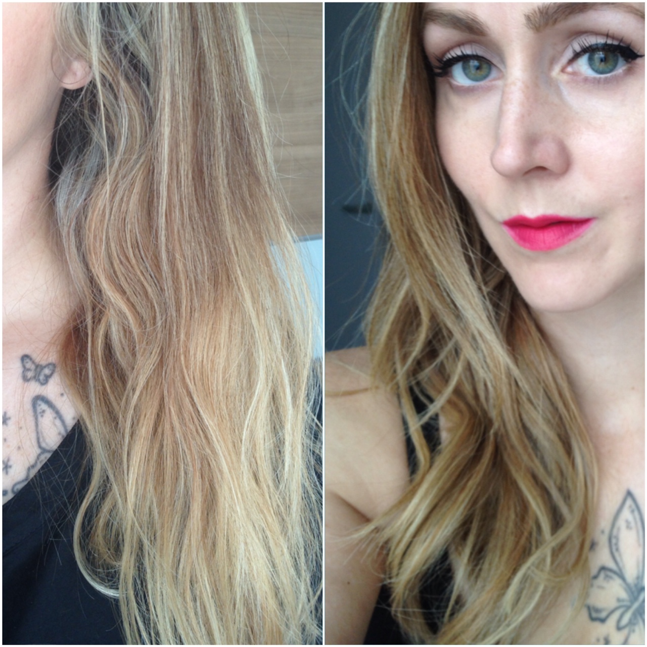 Botox Haar Behandeling Nadelen