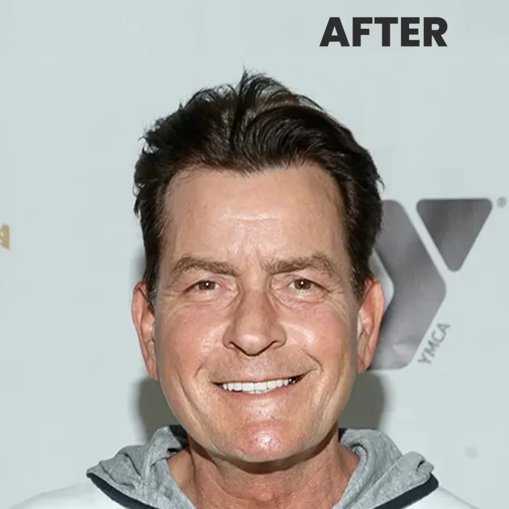 Charlie Sheen Now