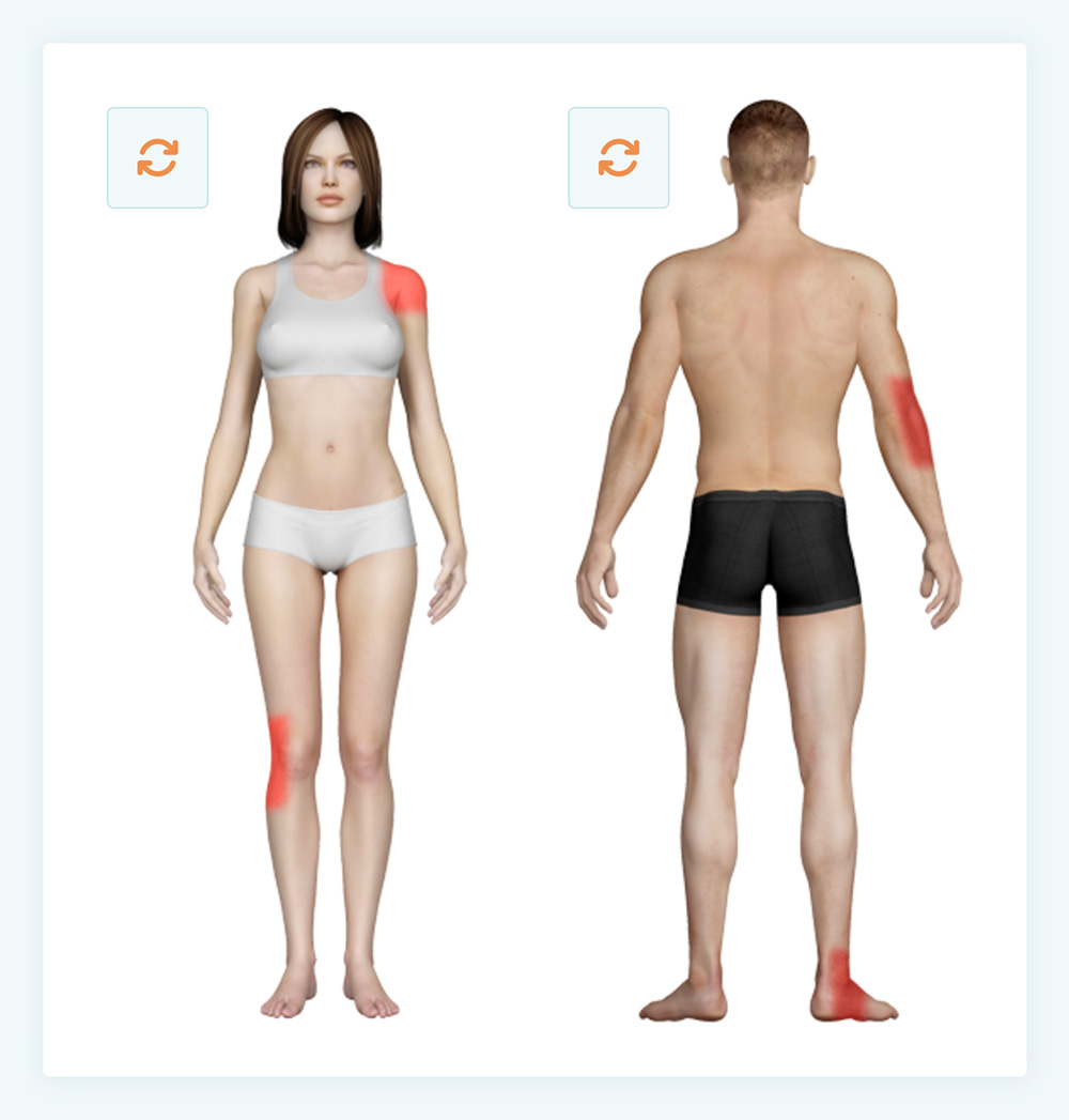 Hierhebikpijn Nl Fysio Check