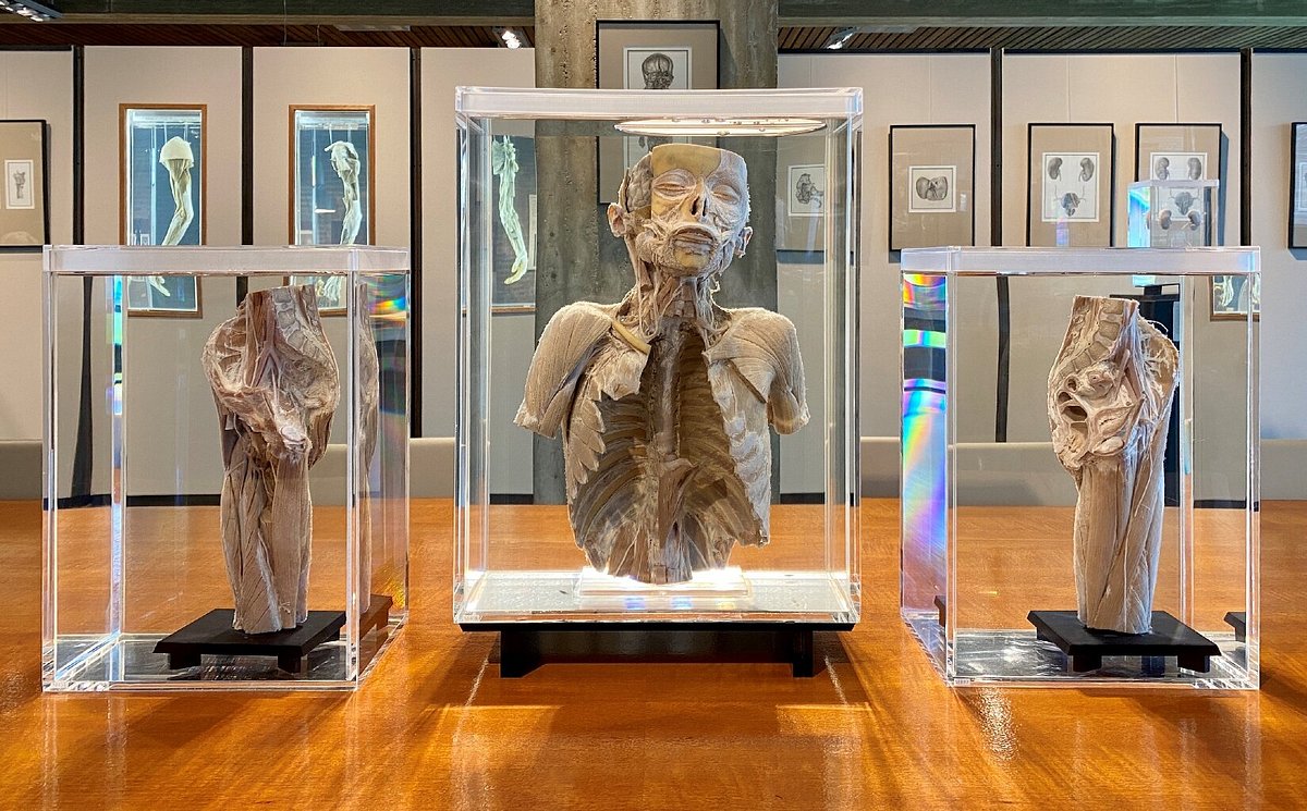 Museum Voor Anatomie En Pathologie Tickets