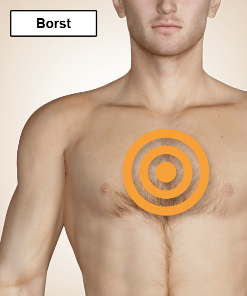 Steken Midden Op De Borst