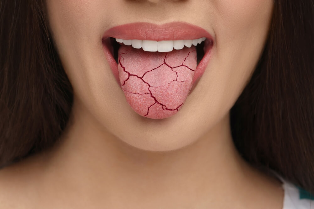 Wakker Worden Met Verstopte Neus En Droge Mond