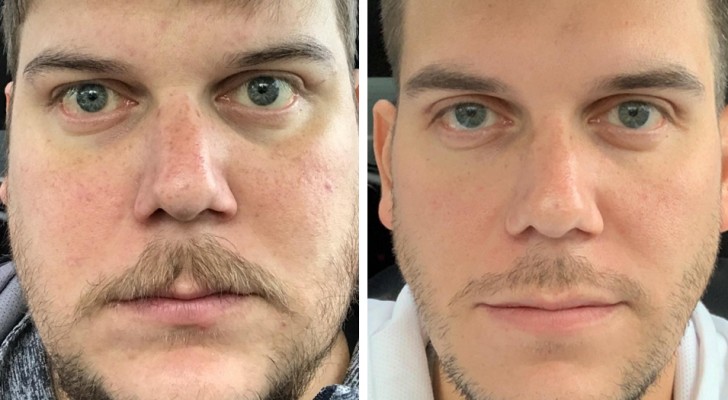 Wat Doet 6 Maanden Geen Alcohol Met Je Lichaam