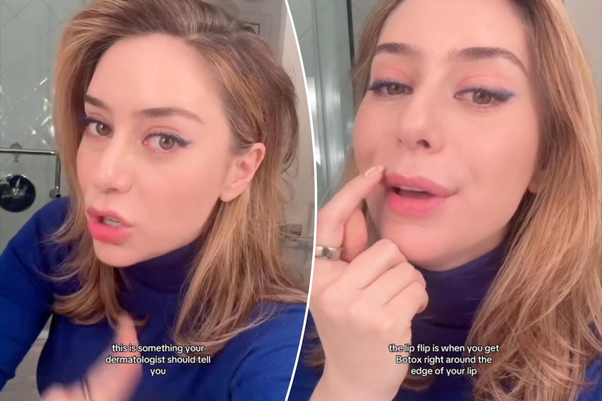 What Is A Lip Flip Gone Wrong With Botox