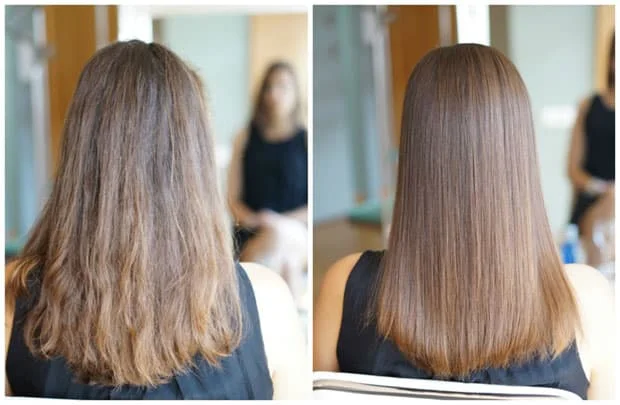 Botox Behandeling Haar Prijs