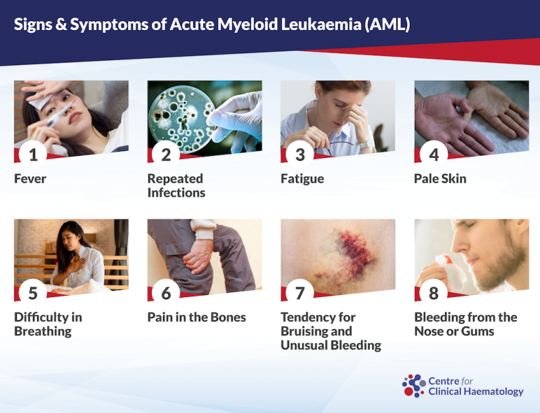 First Stages Of Acute Myeloid Leukemia