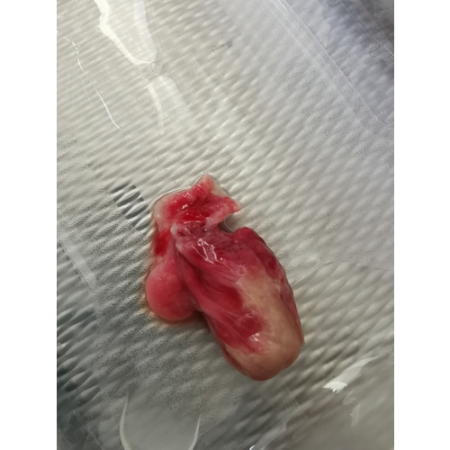 Miskraam 8 Weken Ervaringen