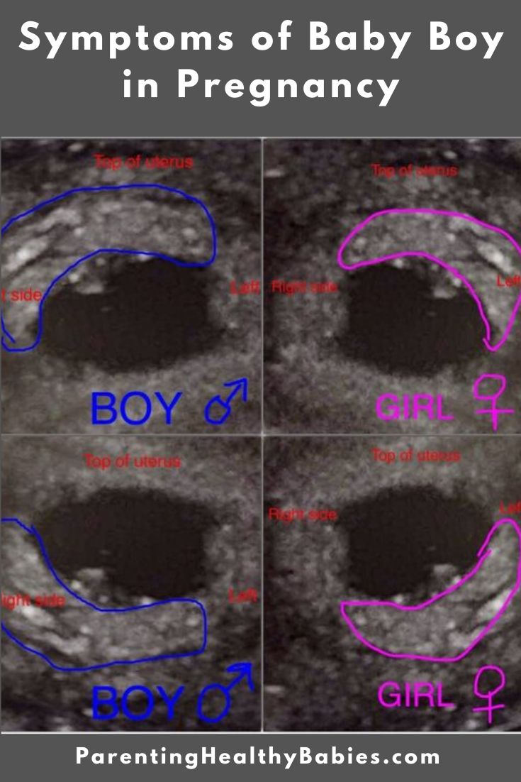 10 Weeks Pregnant Symptoms Of Boy