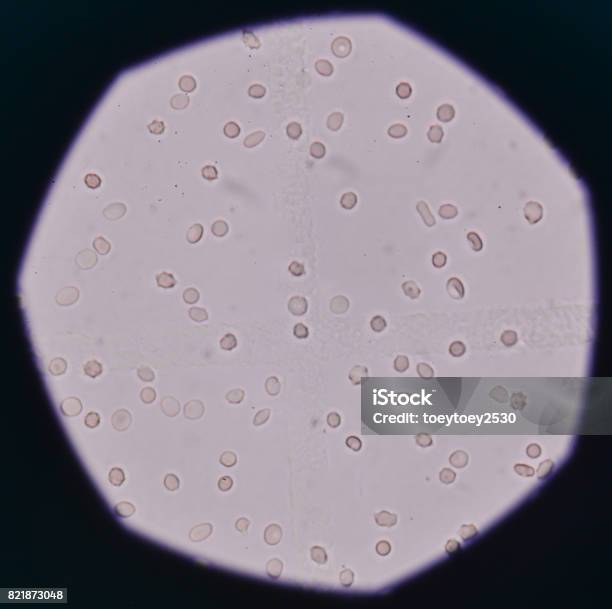 Rode Bloedcellen In Urine