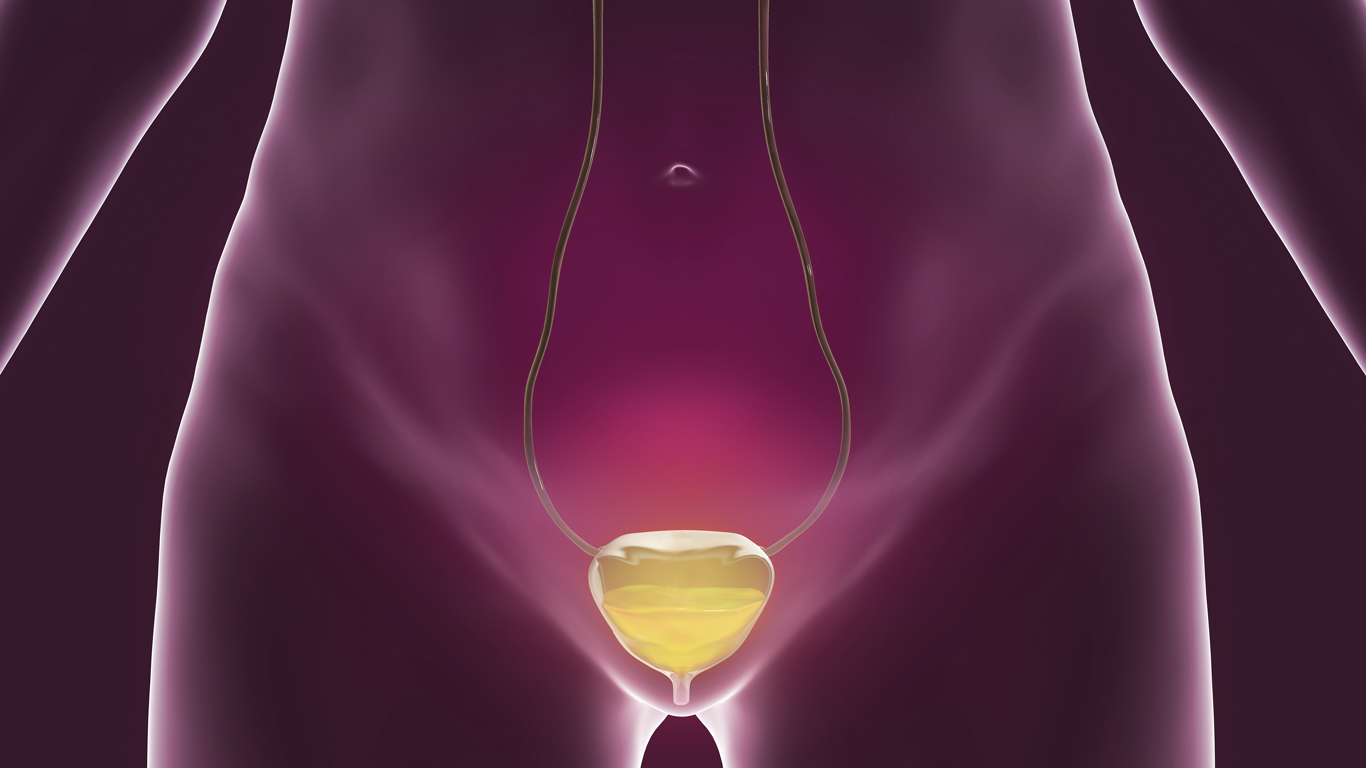 Vergrote Blaas Vrouw