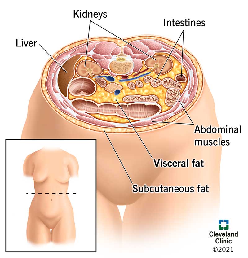 Abdominal Obesity: Definition, Risks & Ways to Reduce