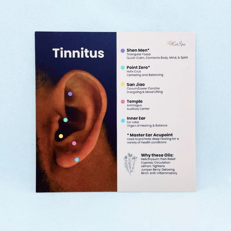 Acupuncture for Tinnitus Near Me: What You Need to Know
