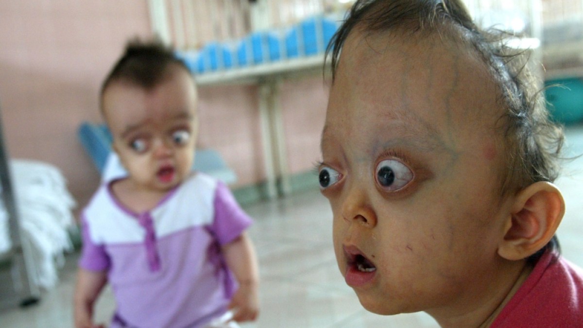 Agent Orange exposure: health risks & compensation
