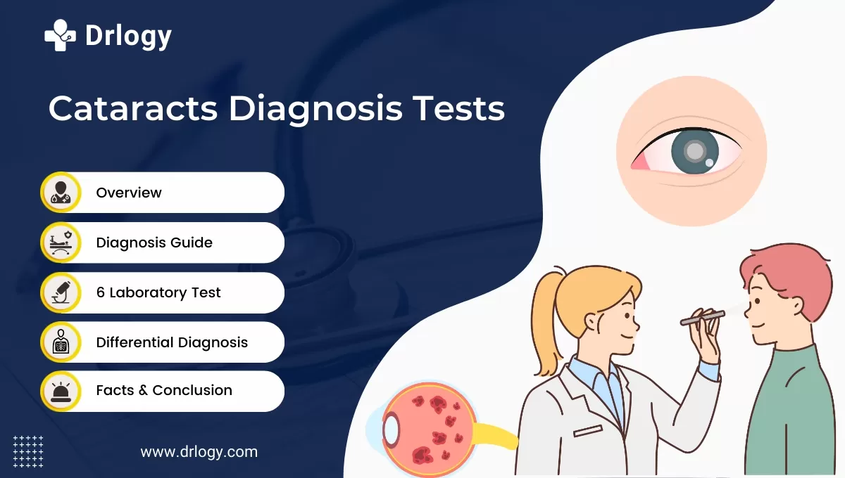 Cataract Diagnosis Test: What You Need to Know Today