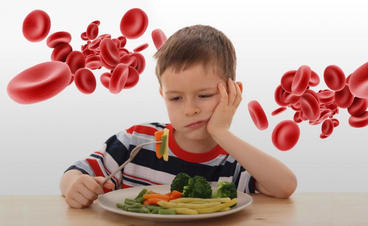 Childhood Anemia: Spot Symptoms, Causes & Treatment
