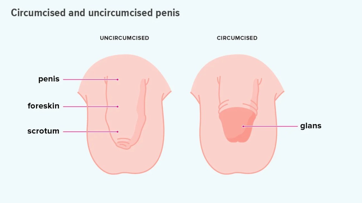Circumcision Benefits – What the Science Really Shows