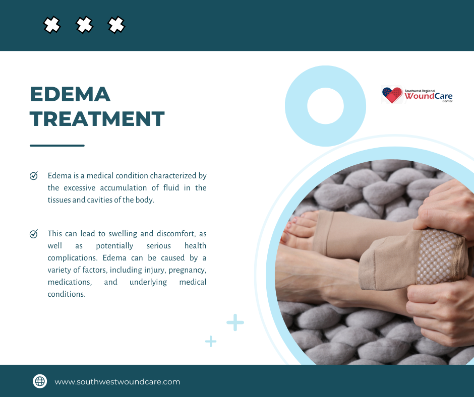 Edema Treatment Options: What Really Works for Swelling?