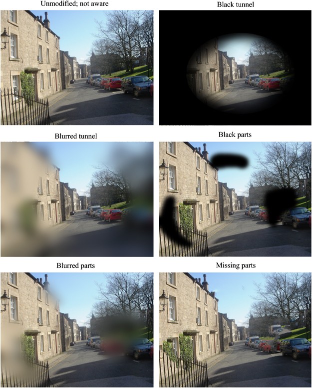 Glaucoma Vision Changes: Spot Early Signs & Take Action
