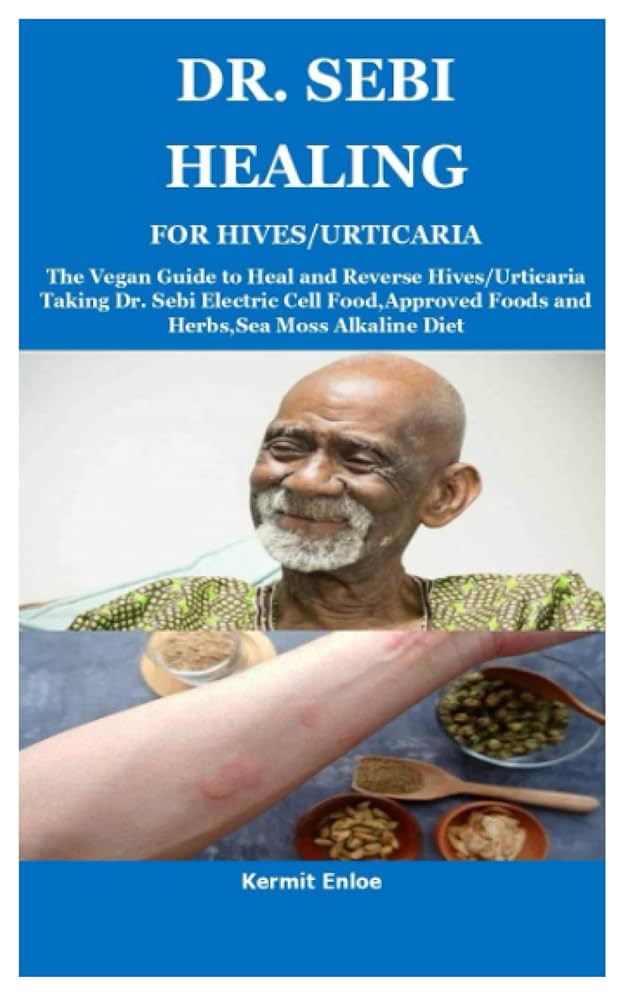 Herbs for Hives: Natural Relief You Can Try Today
