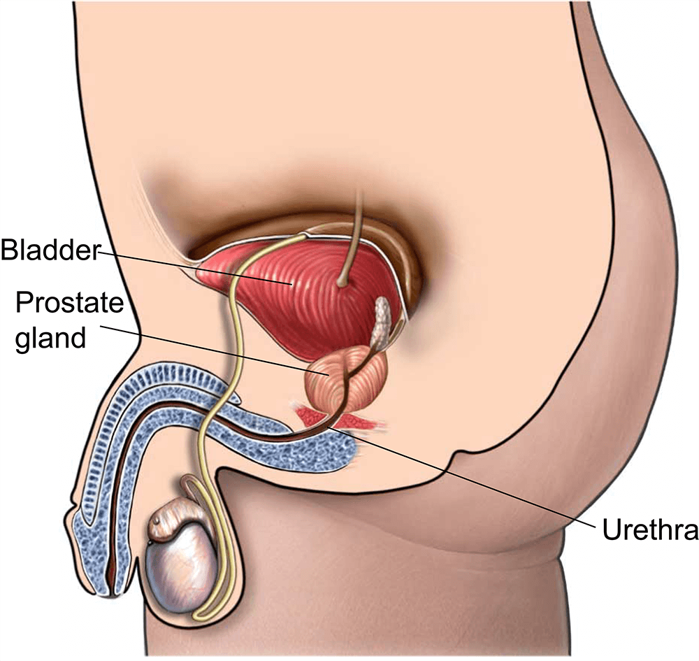 Laparoscopic Prostatectomy: Benefits, Procedure, Recovery