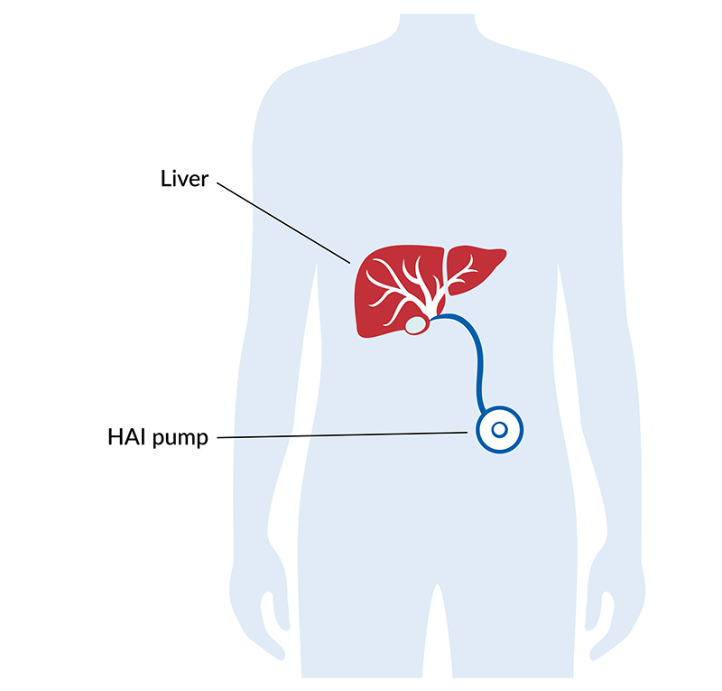 Liver Support Chemo: Protect & Boost Your Liver Health