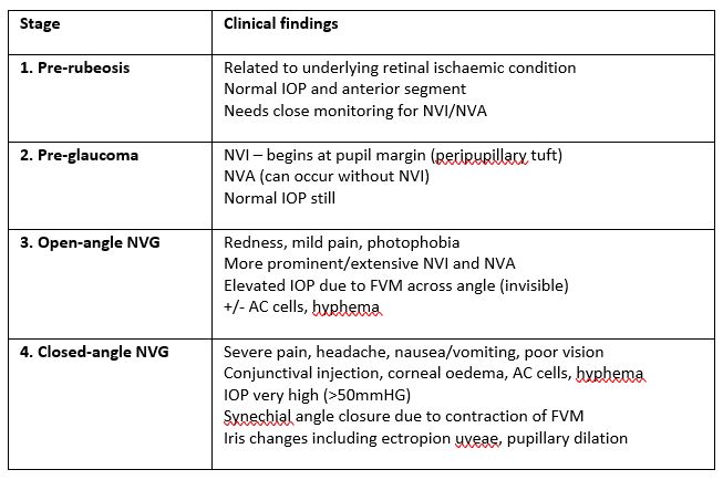 Neovascular Glaucoma Prognosis: What to Expect & Manage