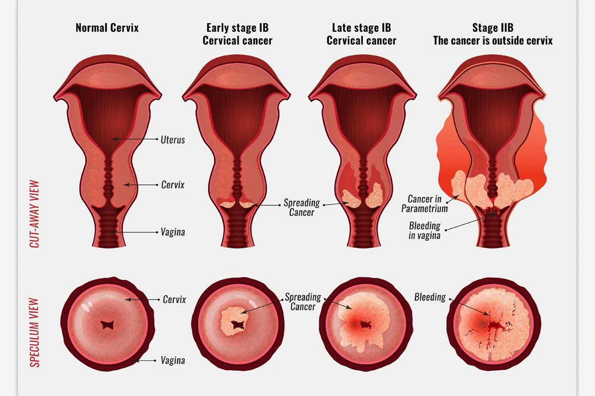 Pregnancy Cervical Changes: What to Expect Each Week