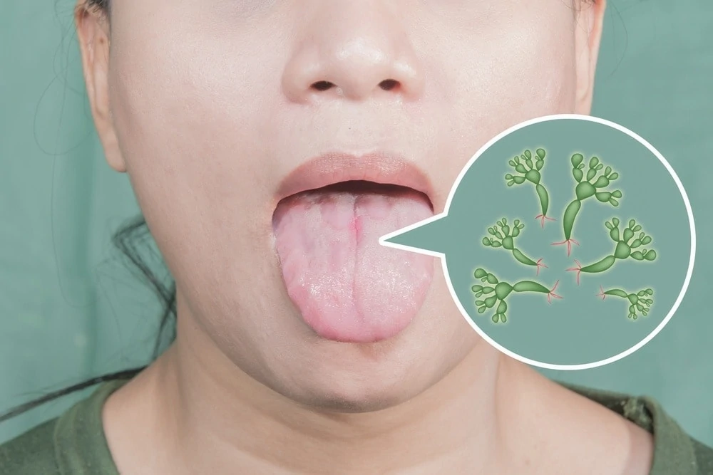Pregnancy Mouth Dryness: Causes, Risks & Fast Relief