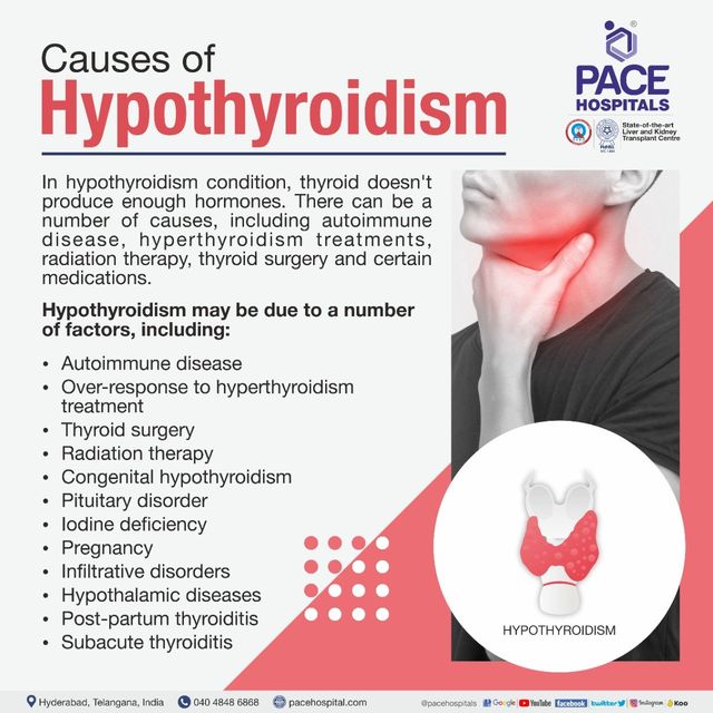 Primary hypothyroidism causes: essential guide you need