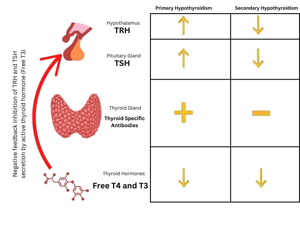 Primary Hypothyroidism: Symptoms, Causes & Treatment