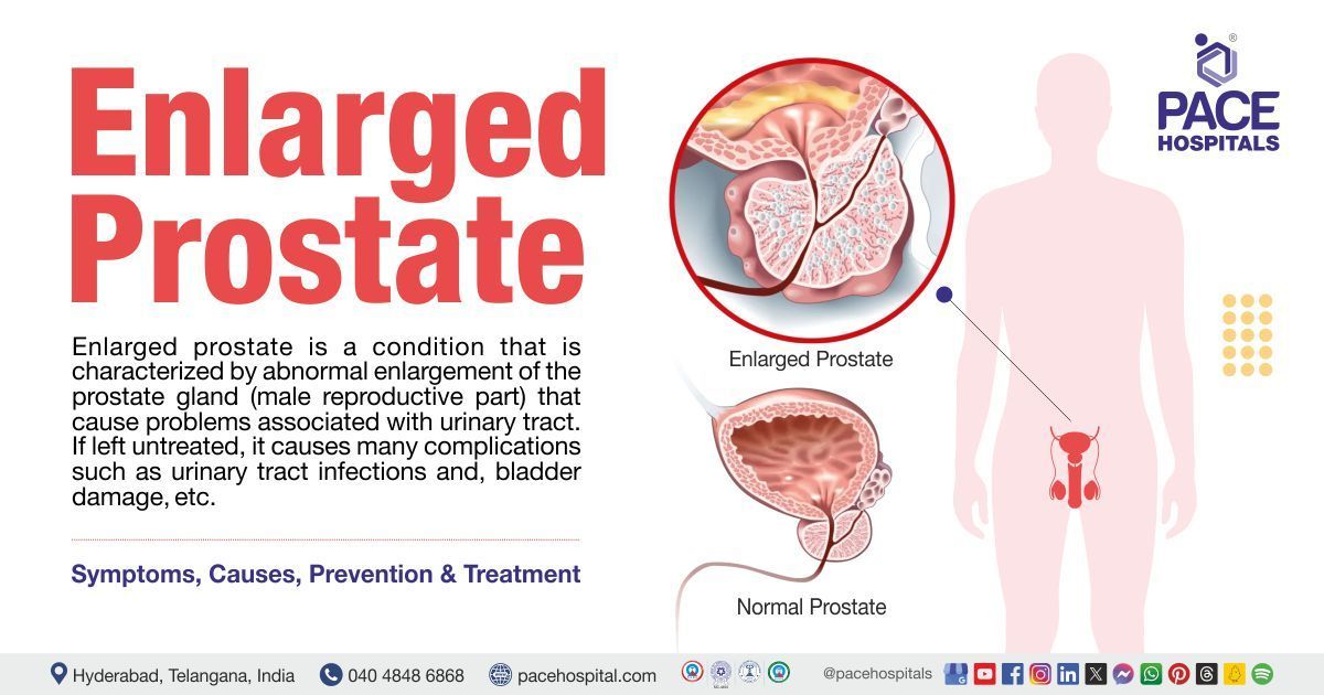 Prostate Enlargement Treatment: Real Relief Options