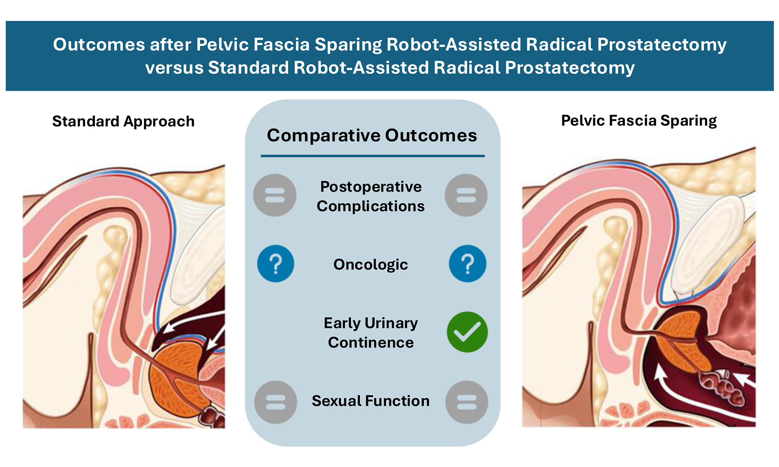 Prostatectomy Outcomes: Expect, Recover & Optimize
