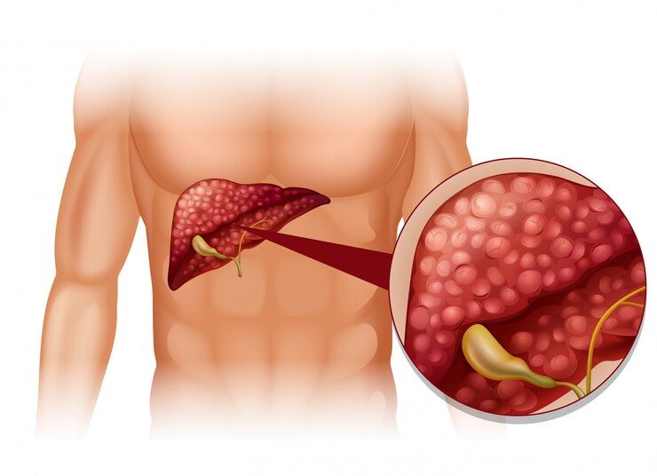 Protect Liver Chemotherapy: Safe Tips During Treatment