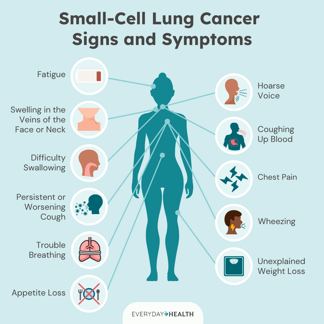 Small Cell Lung Symptoms: Spot the Signs Early