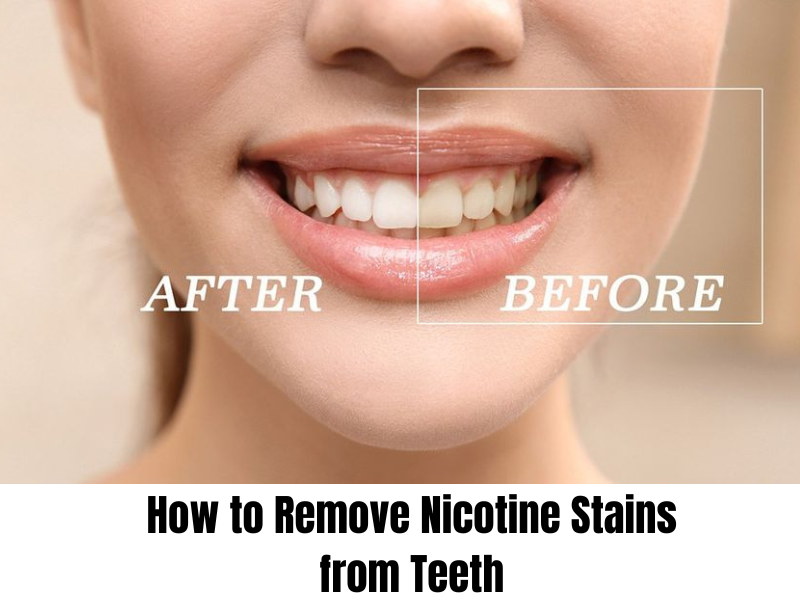 Tobacco Stain Removal: Quick, Safe Ways That Work