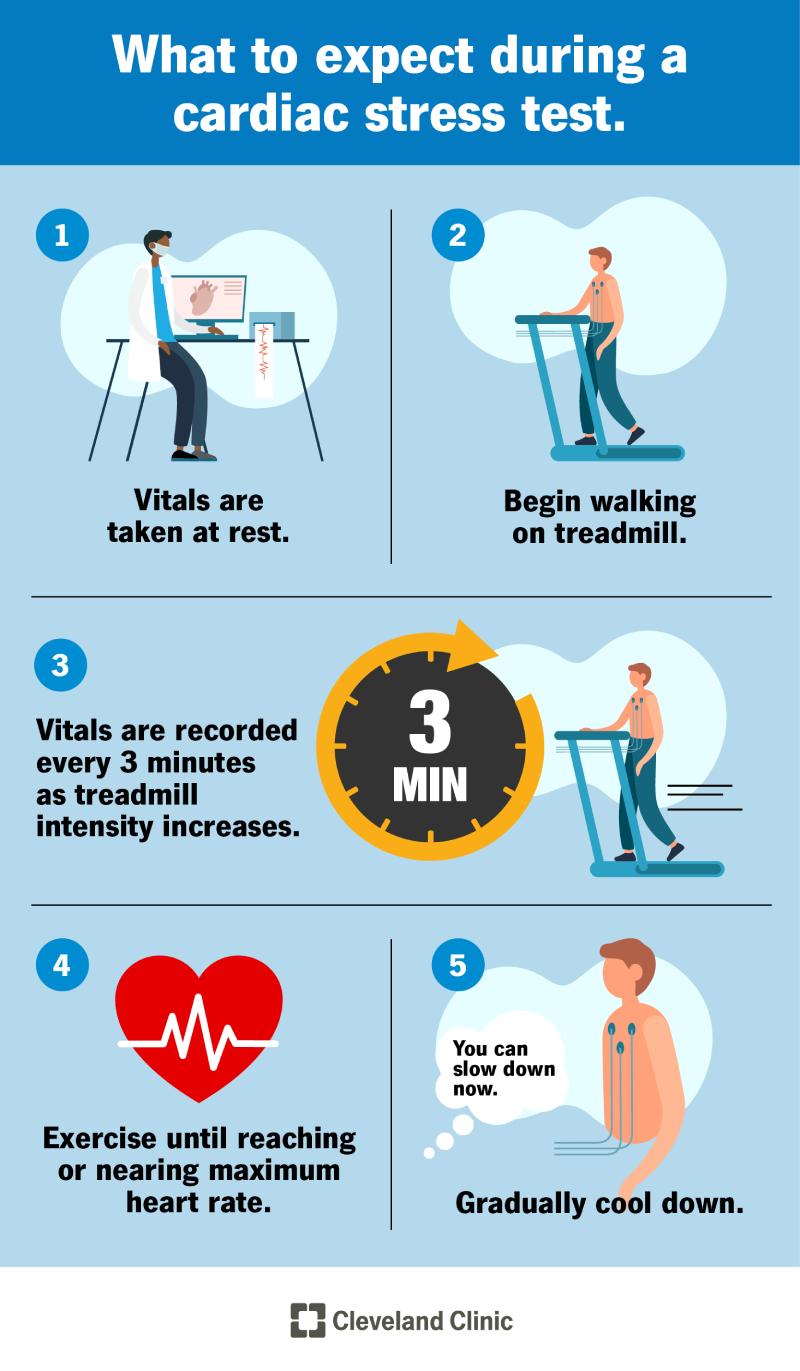 Treadmill Stress Test for Seniors – Key Facts