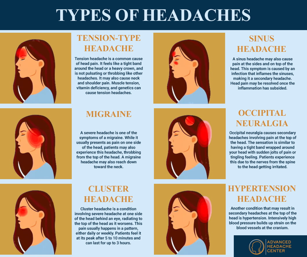 Stress Headache Symptoms – What to Watch For Today