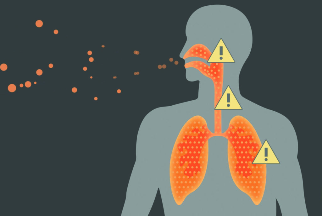 Ammonia Respiratory Distress: Symptoms & First‑Aid