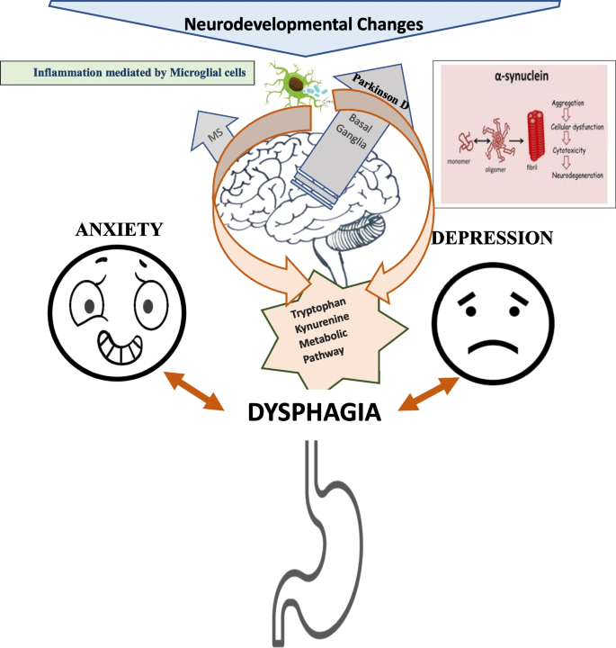 Psychogenic Dysphagia: Symptoms, Diagnosis & Treatment