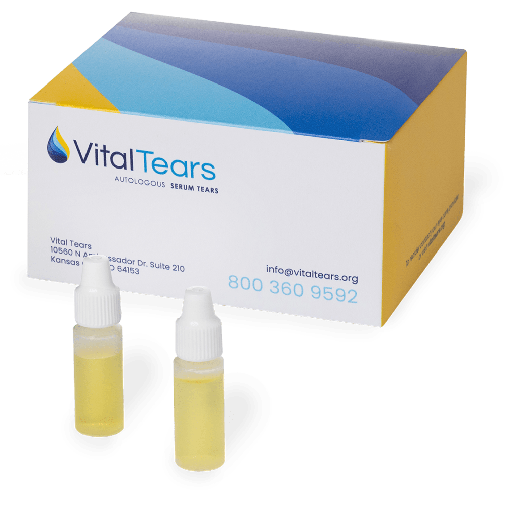 Autologous Serum Eye Drops: What You Need to Know