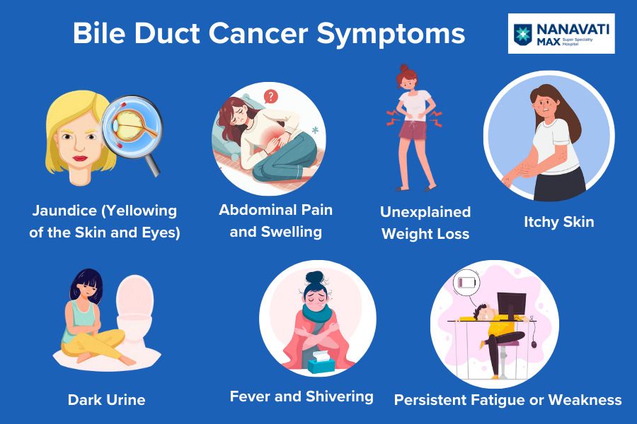 Bile Duct Cancer Symptoms: What You Need to Know