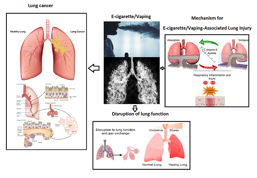 E‑Cigarette Lung Effects: Risks, Healing & Facts