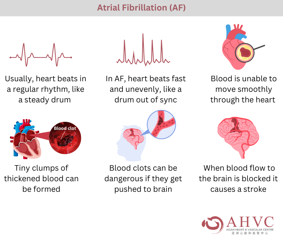 Irregular Heartbeat Clot: What It Means & Why Care