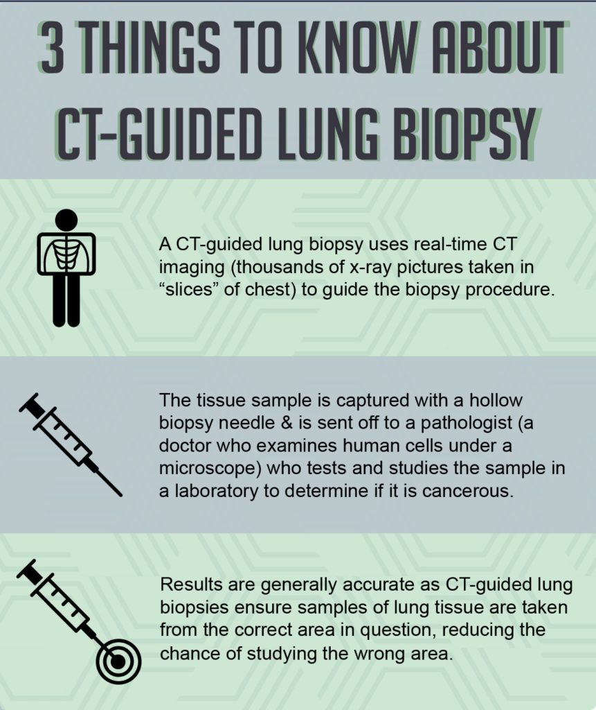 Lung Biopsy Risks: What You Need to Know Before the Procedure