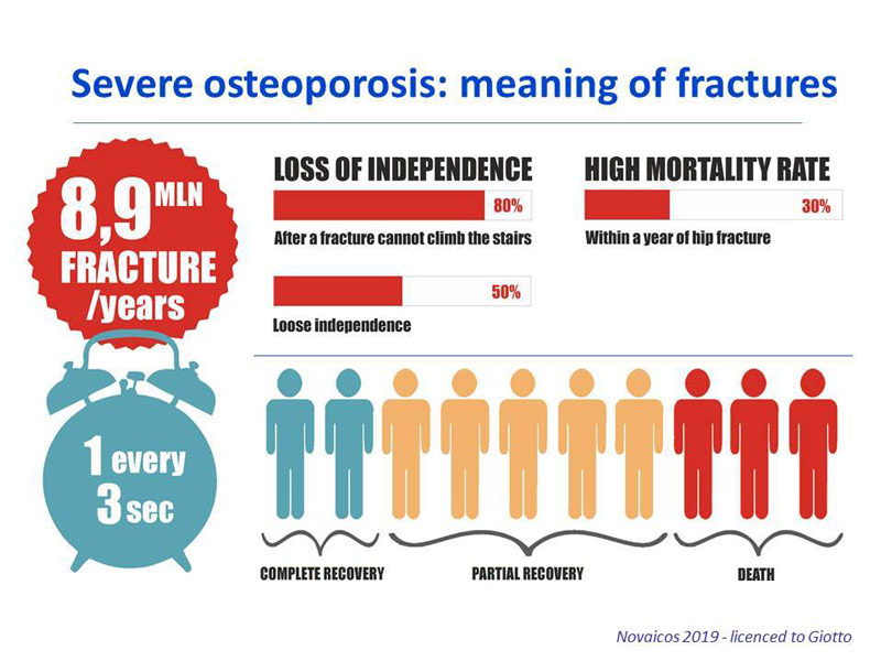 Osteoporosis Prognosis: What to Expect & How to Improve