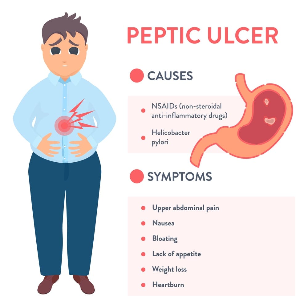 Peptic Ulcer Symptoms: How to Recognize and React